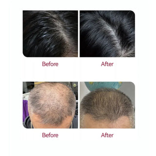 Beaver Anti-Hair Loss Serum 50ml - MV hair and beauty