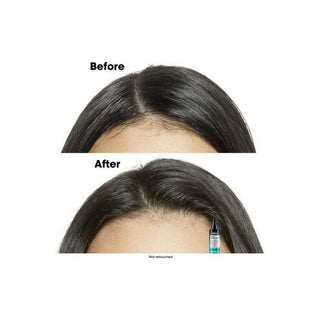L'Oreal Serie Expert Scalp Advanced Anti-Oilyness Serum 90mL - MV hair and beauty