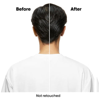 L'Oreal Serie ExpertScalp Advanced Anti Oiliness Mask 250ml