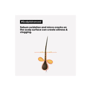 L'Oreal Serie ExpertScalp Advanced Anti Oiliness Mask 250ml